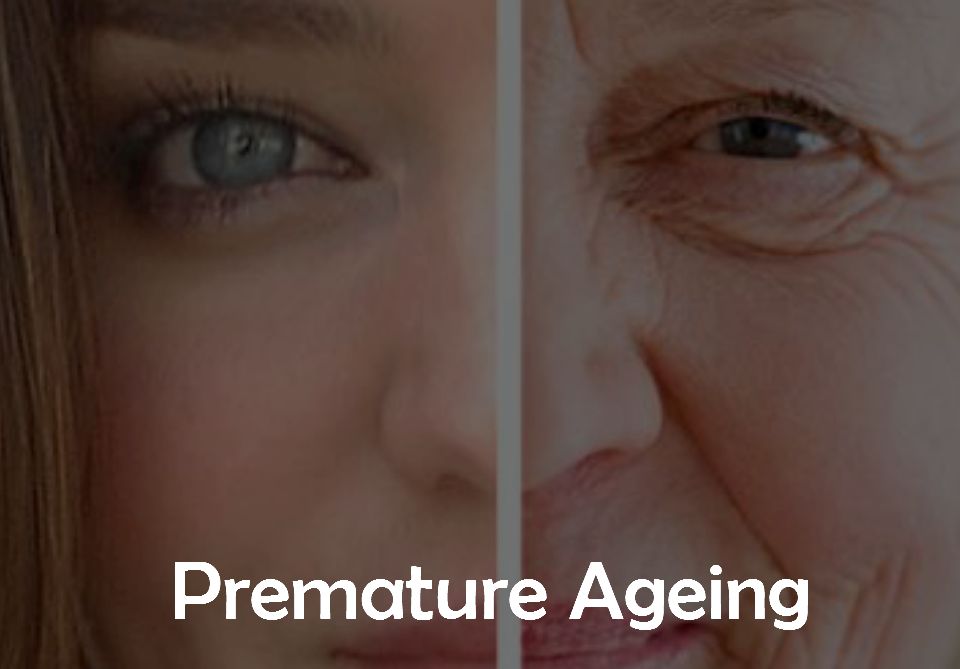 5. Premature Ageing