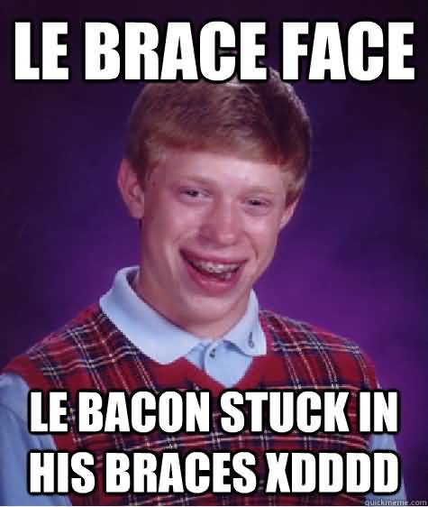 Brace Face Meme Funny Image Photo Joke 14