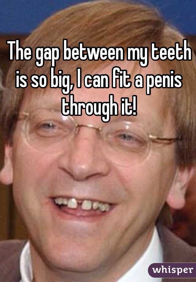 Gap Tooth Meme Funny Image Photo Joke 03