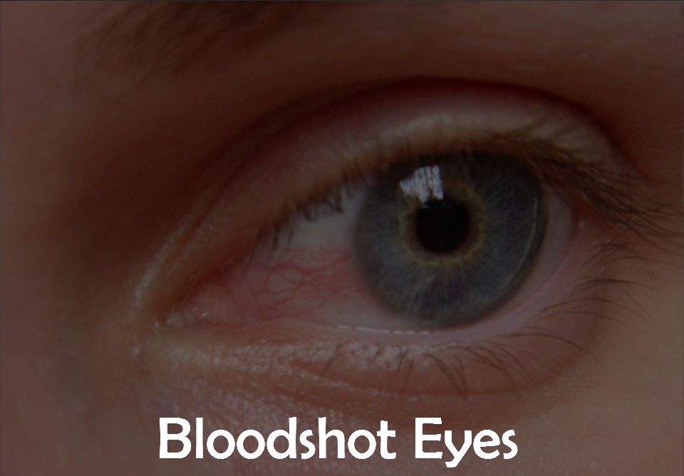 10. Bloodshot Eyes