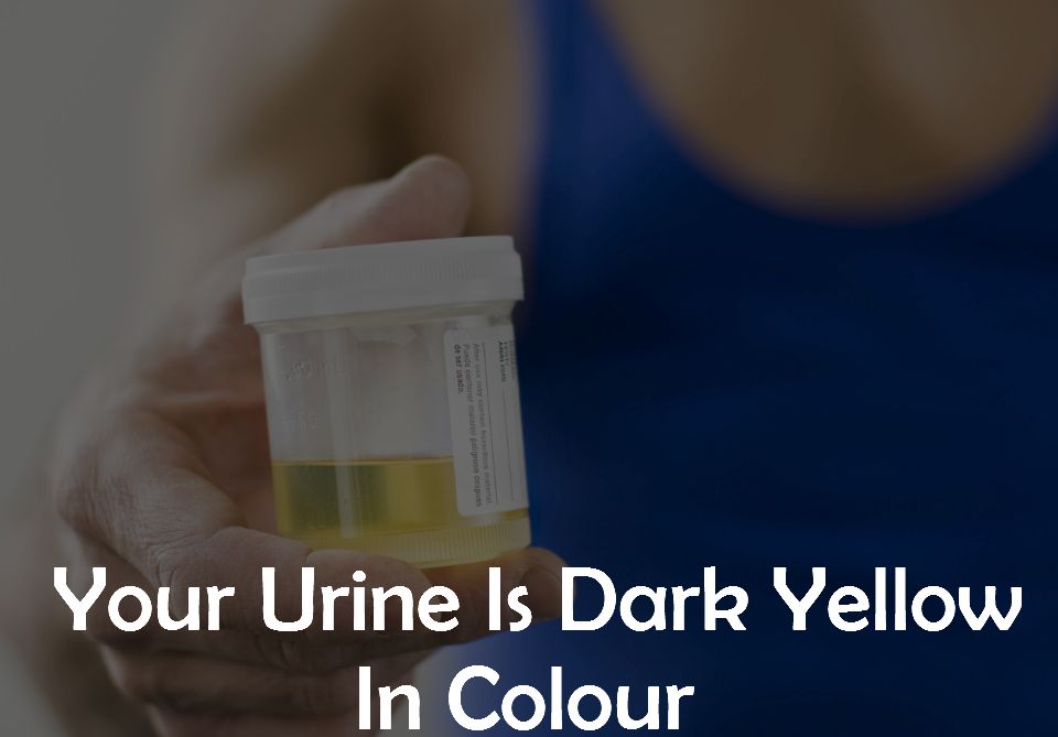 2. Your Urine Is Dark Yellow In Colour