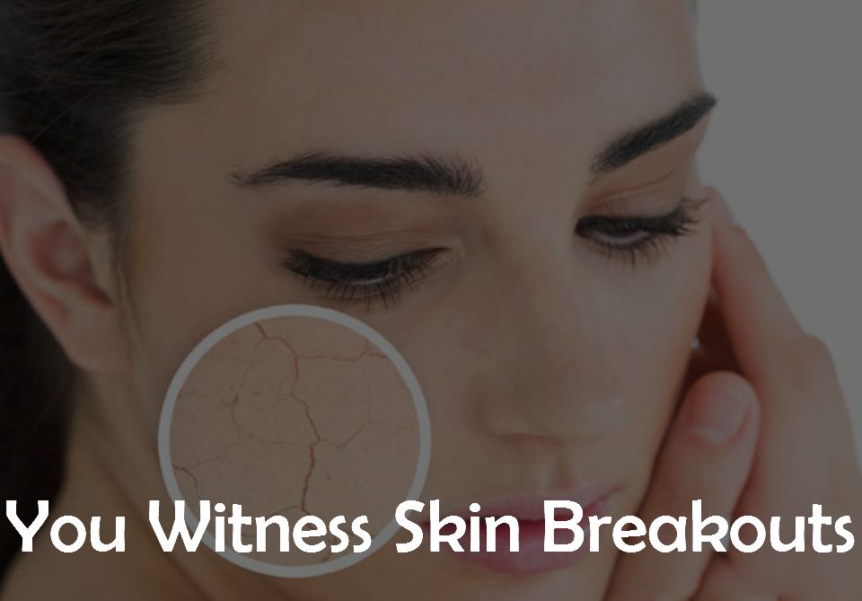 8. You Witness Skin Breakouts